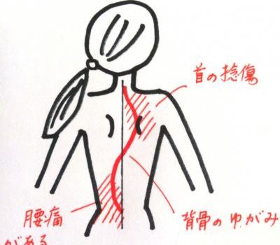 腰痛　ヨガ解剖学
